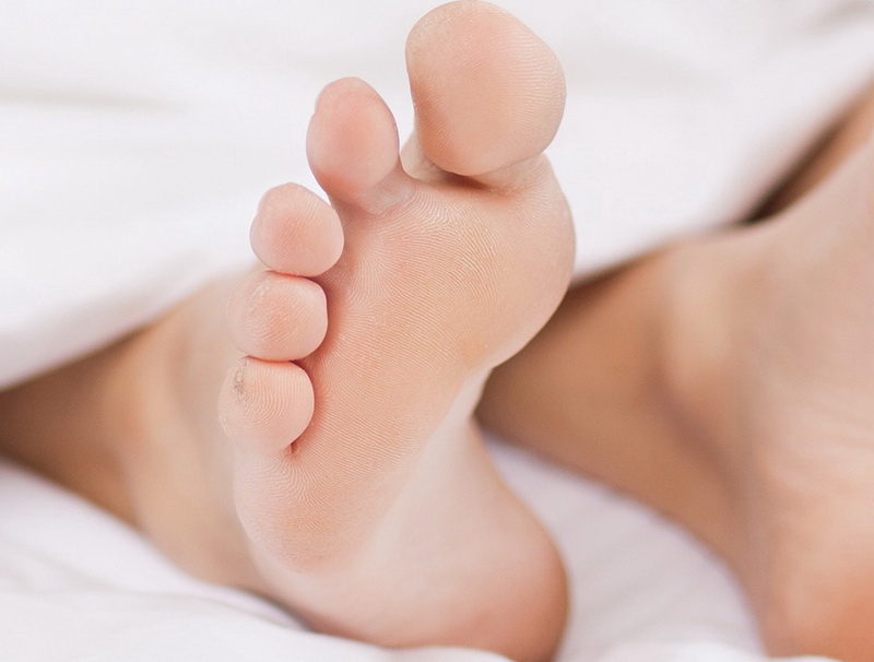 Грибок пальцев ног фото признаки лечение