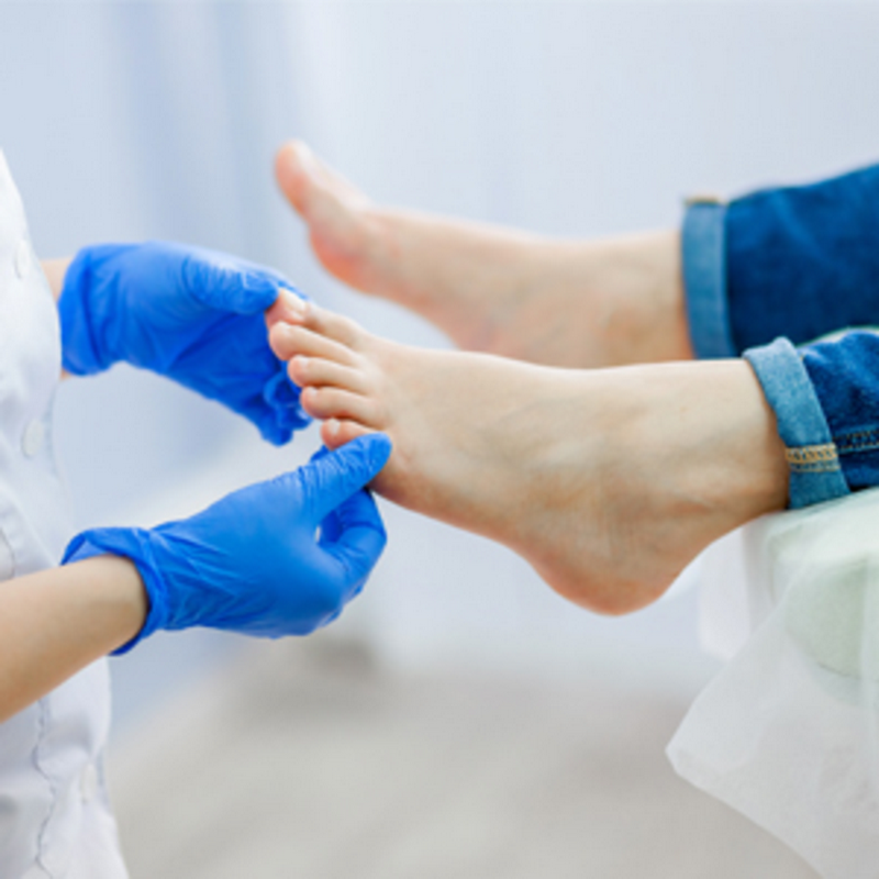 Лечение грибка стопы пальцев ног