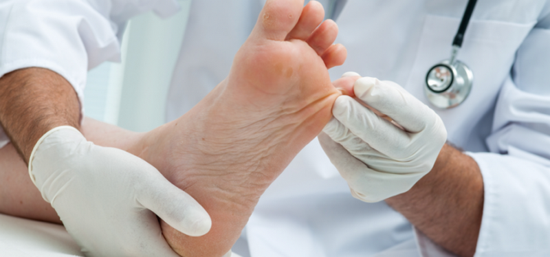 Грибок кожи большого пальца на ноге лечение