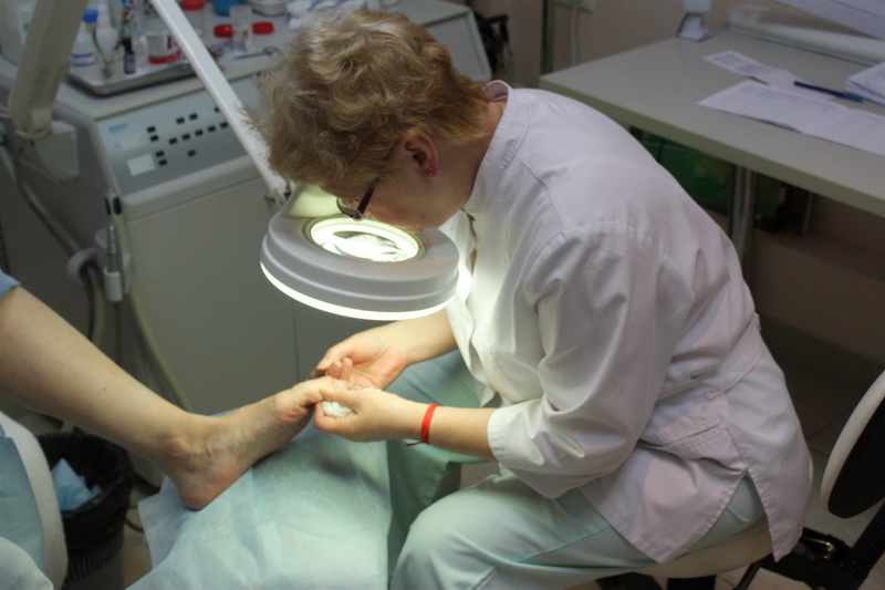 Грибок большого пальца на ноге признаки и лечение